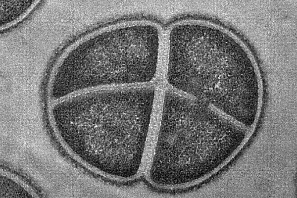  Deinococcus radiodurans,     .