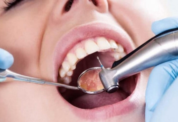 ТОП-5 стоматологий по керамическим винирам